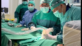 DSA (Digital Substraction Angiography) Pada Bayi Usia 1 Tahun dengan Gejala Stroke