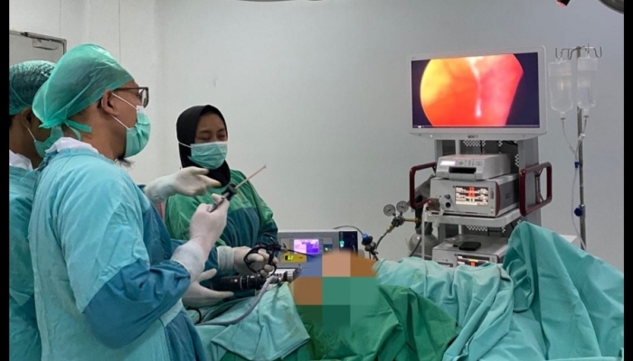 Laparoskopi Kolesistektomi atau Bedah Teropong Batu Empedu di RSUD Blambangan 